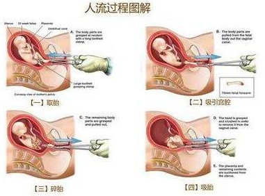 昆明女性人流前应该检查什么项目